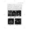 胎儿MRI 张国福 张鹤 主编 本书对从事胎儿磁共振的影像科医师和新生儿医师、产科医师都有帮助 9787547873083 上海科学技术出版社 商品缩略图4