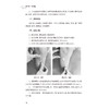 中医护理技术操作与案例 邓少娟 杨湘薇 本书涉及操作项目包括刮痧拔罐放血疗法雷火灸捏脊针四缝督灸等34项技术 人民卫生出版社 商品缩略图4