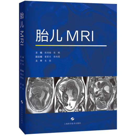 胎儿MRI 张国福 张鹤 主编 本书对从事胎儿磁共振的影像科医师和新生儿医师、产科医师都有帮助 9787547873083 上海科学技术出版社 商品图1