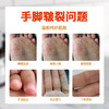 奥姿抗裂修护霜防裂脚裂膏脚后跟龟裂手裂口干裂蜕皮手足护手霜 商品缩略图2