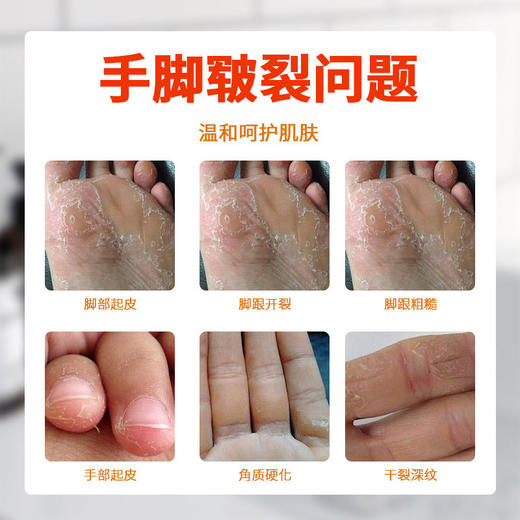 奥姿抗裂修护霜防裂脚裂膏脚后跟龟裂手裂口干裂蜕皮手足护手霜 商品图2
