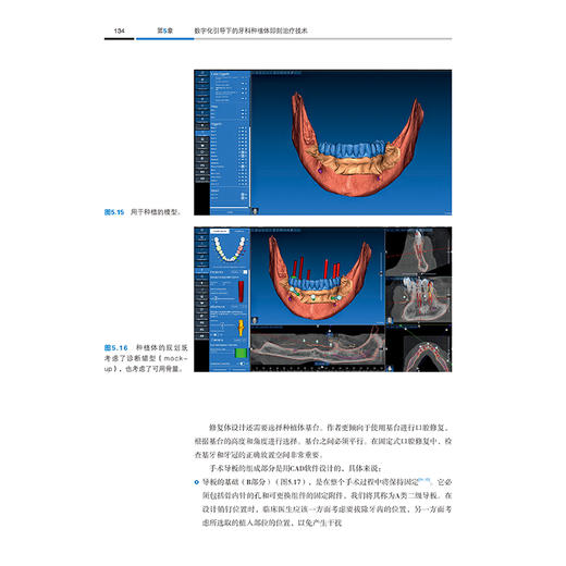 种植与修复数字化技术 从椅旁到数字化概念技术 陈庆生 沈建伟 范洪领 金华旦 主译 种植 修复 9787559143402辽宁科学技术出版社 商品图3