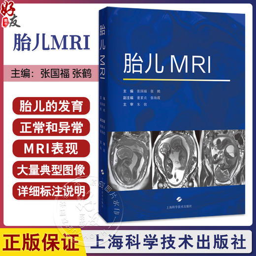 胎儿MRI 张国福 张鹤 主编 本书对从事胎儿磁共振的影像科医师和新生儿医师、产科医师都有帮助 9787547873083 上海科学技术出版社 商品图0