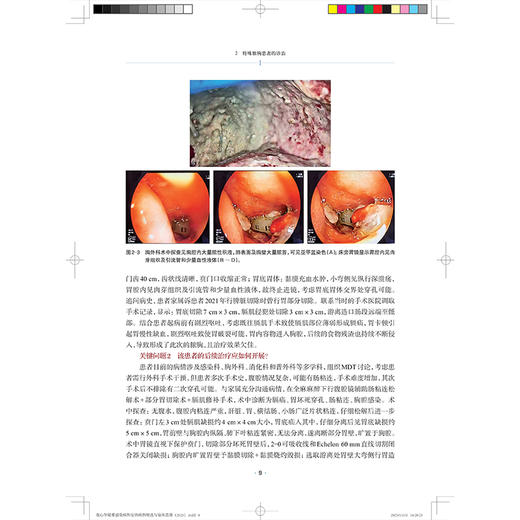 翁心华疑难感染病和发热病例精选与临床思维(2025) 张文宏 张继明 对感染病相关专业的医务工作者有较大的参考价值上海科学技术出版社 商品图4