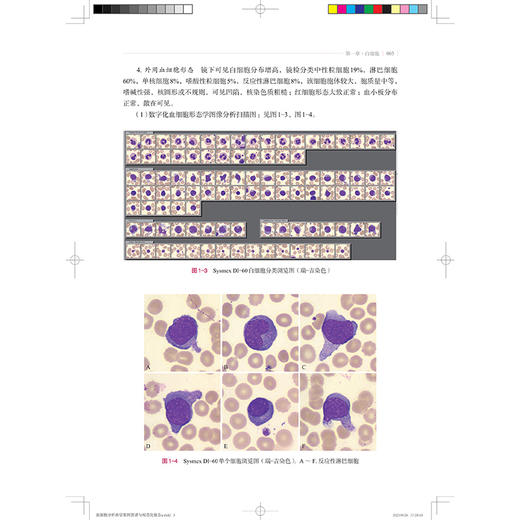血细胞分析典型案例图谱与规范化报告 张丽霞 王珏 蒋茜 主编 适用各级临床检验人员及检验专业学生和住院医师 上海科学技术出版社 商品图4