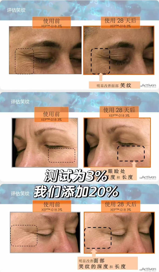 预定3天发：速除皱不僵脸医美级别注/射升级全纯进口原料高配置黑番茄三重肉毒面霜类肉毒霜30g（镁白+除/皱+光损） 商品图6