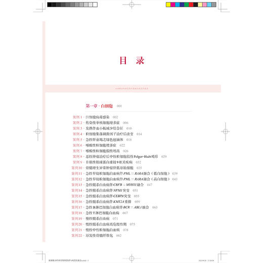 血细胞分析典型案例图谱与规范化报告 张丽霞 王珏 蒋茜 主编 适用各级临床检验人员及检验专业学生和住院医师 上海科学技术出版社 商品图3