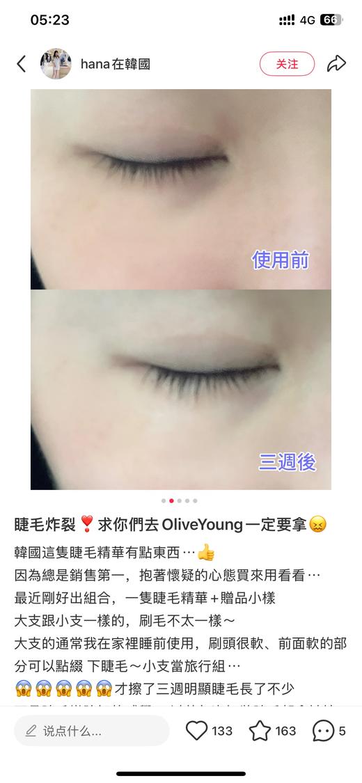 睫毛增*长液 商品图8