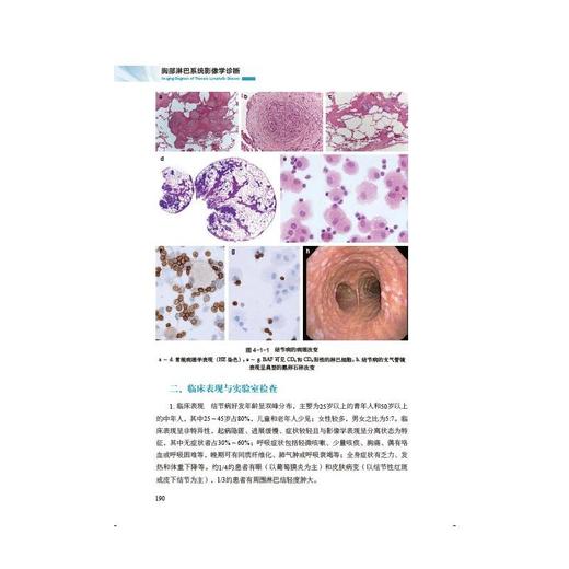 胸部淋巴系统影像学诊断 商品图1