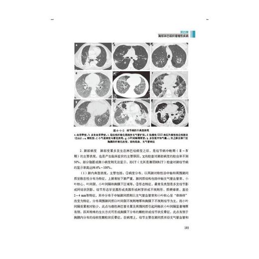胸部淋巴系统影像学诊断 商品图4
