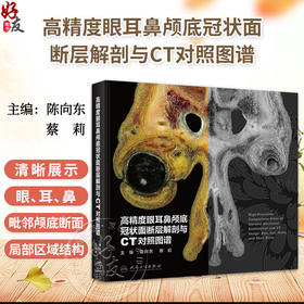 高精度眼耳鼻颅底冠状面断层解剖与CT对照图谱 陈向东 蔡莉 截取眼、耳、鼻及毗邻颅底的局部区域图像 共112幅图像 人民卫生出版社