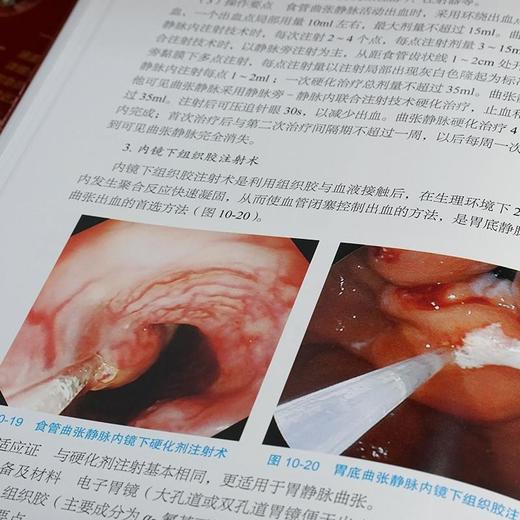 实用急诊消化内镜技术 商品图2