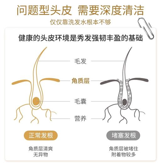 定制【礼盒装49元】防脱固发套组防脱洗发水250ml*2+洗发水125ml+按摩膏25ml 商品图5