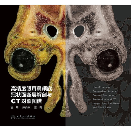 【预售】高精度眼耳鼻颅底冠状面断层解剖与CT对照图谱 商品图1