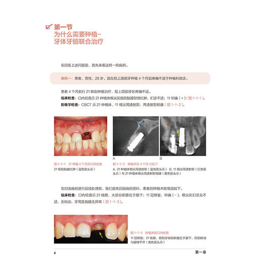 口腔种植规范化治疗清单——种植遇到邻牙根尖周病多学科联合治疗 满毅 黄定明 主编 口腔科学 西医 9787117384155人民卫生出版社 商品图4