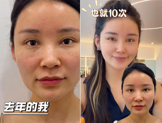 超值新品！在家打出水光肌！“千元院线级效果” ！SUXIE塑写 居家水光超值套组 玻尿酸水光精华6支装 赠30片面膜+30支次抛+时空超导仪 商品图14