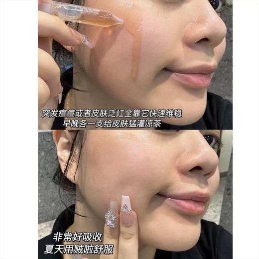 芙清凉茶次抛精华液 快速祛痘修红控油舒缓敏肌泛红淡化痘印 商品图5