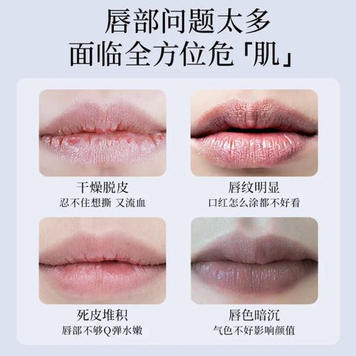 百蕾适 · 美国Blistex碧唇小蓝罐保湿滋润去死皮淡化唇纹修护舒缓润唇膏 7g 商品图4