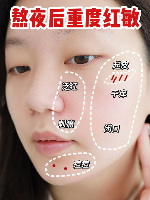 华熙重磅新品！润百颜4重玻尿酸屏障调理安肌睡眠面膜 商品图5