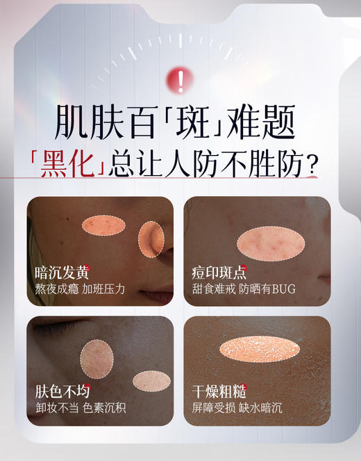 【直击根源 摆脱斑点肌】透真377美白次抛精华液烟酰胺VC淡斑抗氧化提亮去黄改善暗沉 商品图1