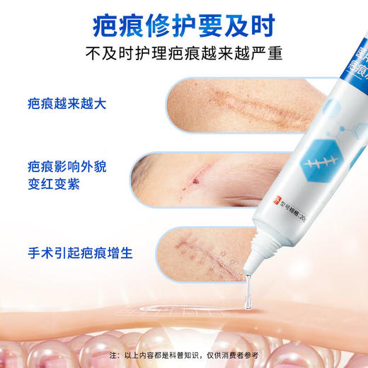 北京同仁堂医用疤痕凝胶20g 祛疤膏改善烧伤烫伤摔伤专用膏除脸部外伤剖腹产手术刀伤疤痕灵 商品图4