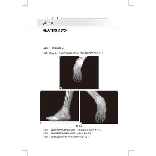 肌骨系统疾病放射影像诊断思维与决策 住院医师规范化培训结业临床实践能力考核题库 袁慧书 曾自三 9787117386999 人民卫生出版社 商品图4