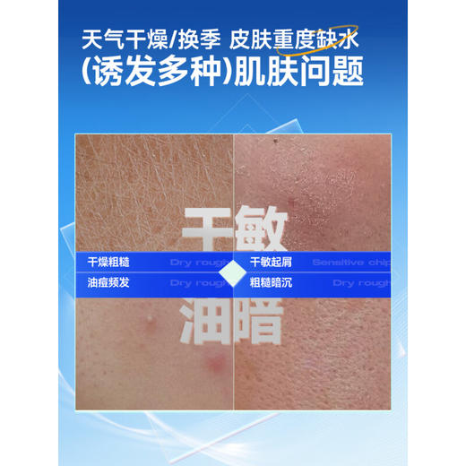 左颜右色 氨基酸水活面霜男士护肤补水保湿霜50g擦脸霜滋润润肤霜护肤品 商品图2