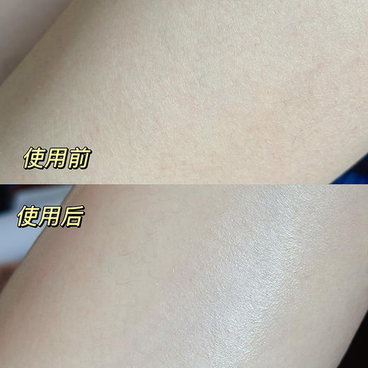 【任意2瓶减10 】【以油养肤 身体精华油】润肤油 洗完澡趁身上还有点湿润的时候涂，按摩两下就吸收干净，不会黏睡衣也不会沾床单 湖州仓 商品图1