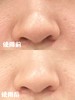 韩国oliveyoung热卖爆品ilso一苏黑头导出液150ml黑头水控油祛黑头粉刺温和无刺激【含湿敷棉片*1盒+黑头铲*1】 商品缩略图4