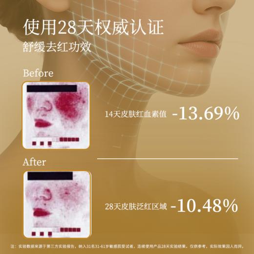 Massada玛莎达 益生元修复精华油 30ml 商品图5