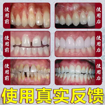 同仁堂溶菌酶美洁白牙膏口臭黄牙渍烟渍茶渍牙垢烟酰胺亮牙膏100g*3支 /个人护理 /口腔护理 /牙膏 商品图3