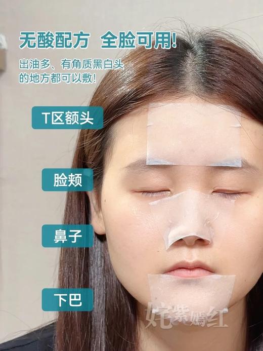 韩国oliveyoung热卖爆品#ilso一苏黑头导出液150ml黑头水控油祛黑头粉刺温和无刺激 商品图3