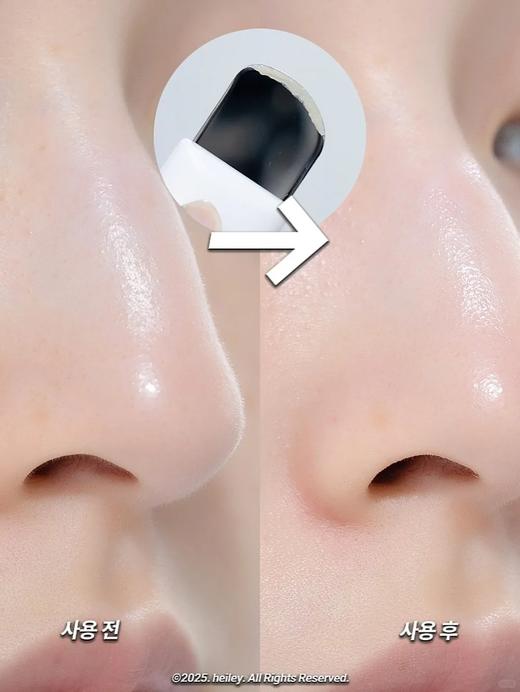 韩国oliveyoung热卖爆品HelloKitty联名款ilso黑头导出液水韩国一苏溶解闭口粉刺收缩毛孔 商品图5