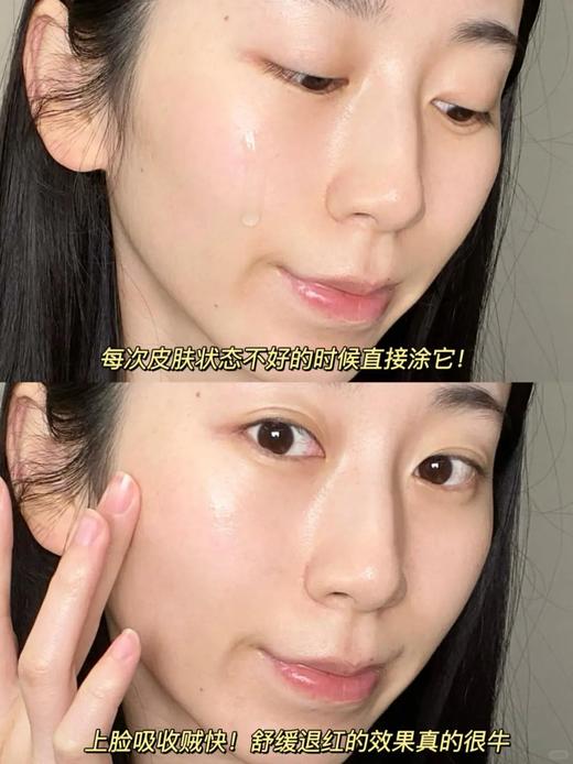 【伯纳赫重组胶原蛋白凝胶敷料30g】肤感清爽，成分安全无刺激，有修护肌肤屏障的功能！非慢性创面如面部痤疮引起的皮肤屏障损伤及周围皮肤的护理，中通快递 商品图10