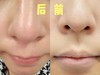 韩国oliveyoung热卖爆品#ilso一苏黑头导出液150ml黑头水控油祛黑头粉刺温和无刺激 商品缩略图4