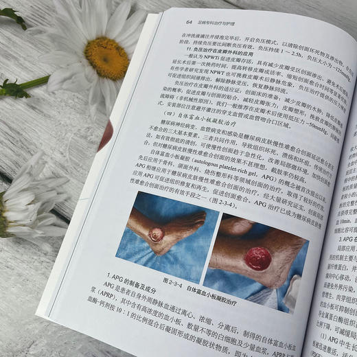 足病专科治疗与护理 商品图3