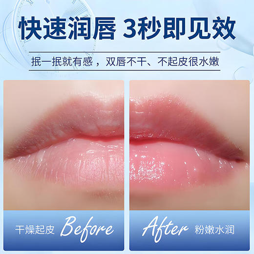 【保税仓】Vaseline/凡士林修护膏100ML（有效期至28年2月） 商品图2