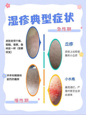 宝宝被湿疹“赖上”不用怕，教你正确应对！