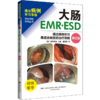 大肠EMR•ESD——通过病例学习最适合病变的治疗策略（附视频） 商品缩略图0