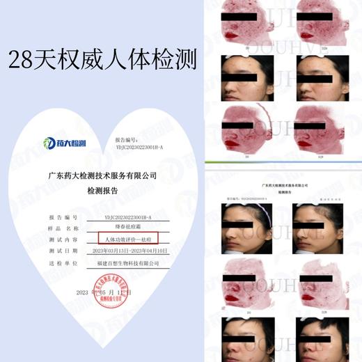 姜黄中药养肤祛痘霜痘痘闭口红肿粉刺敏肌修护褪红痘印男女15g 商品图1