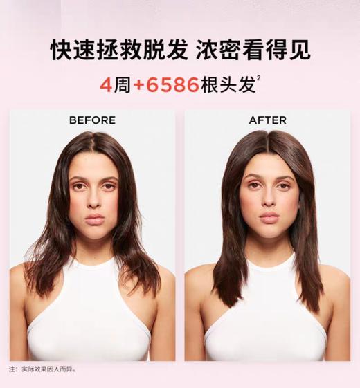 保 K诗元气姜精华滴液生发精油 商品图5