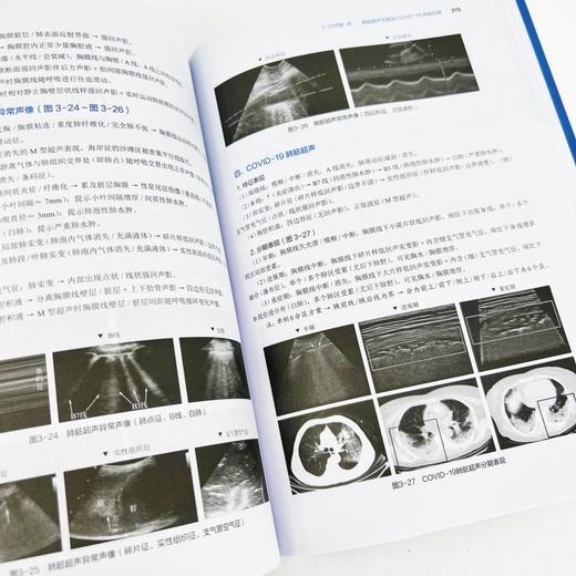 感染科青年医师进阶手记 : 从理论到临床 商品图7