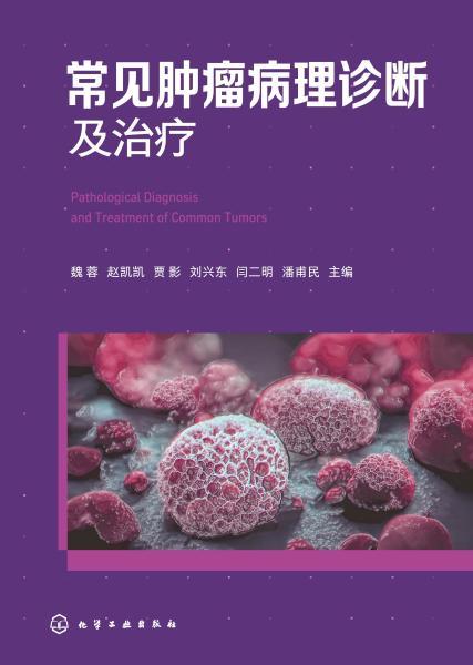 常见肿瘤病理诊断及治疗 商品图1