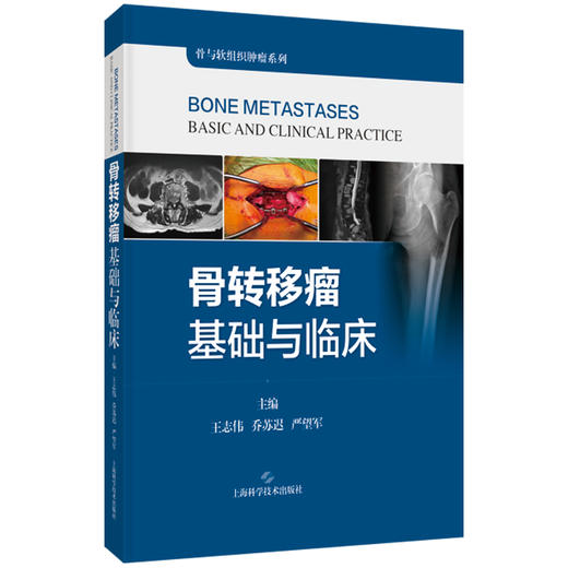 骨转移瘤基础与临床 骨与软组织肿瘤系列 王志伟 乔苏迟 严望军 主编 适用骨科医生 肿瘤科医生 9787547874295上海科学技术出版社 商品图1