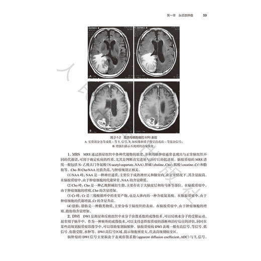 癌症早期筛查与健康管理 吴春维 李伟 每个癌种分别从流行病学现状与危险因素 随访策略与健康管理等方面进行了阐述人民卫生出版社 商品图4
