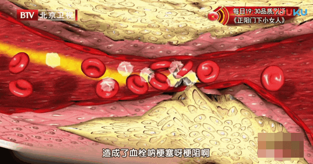 它是天然“血管支架”，不想血管堵要多吃！清走坏脂肪，血脂稳下来，斑块绕道走～