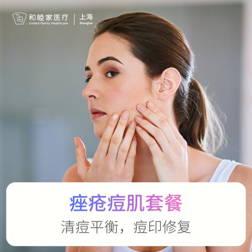 痤疮痘肌套餐 商品图0