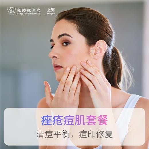 痤疮痘肌套餐 商品图2