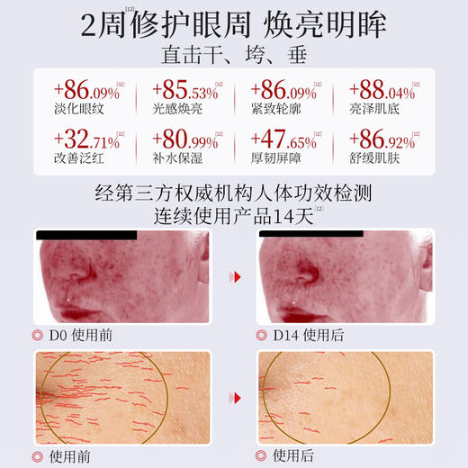 【眼油】金蛇多效抗皱紧致精华油 眼油 9ml 商品图1