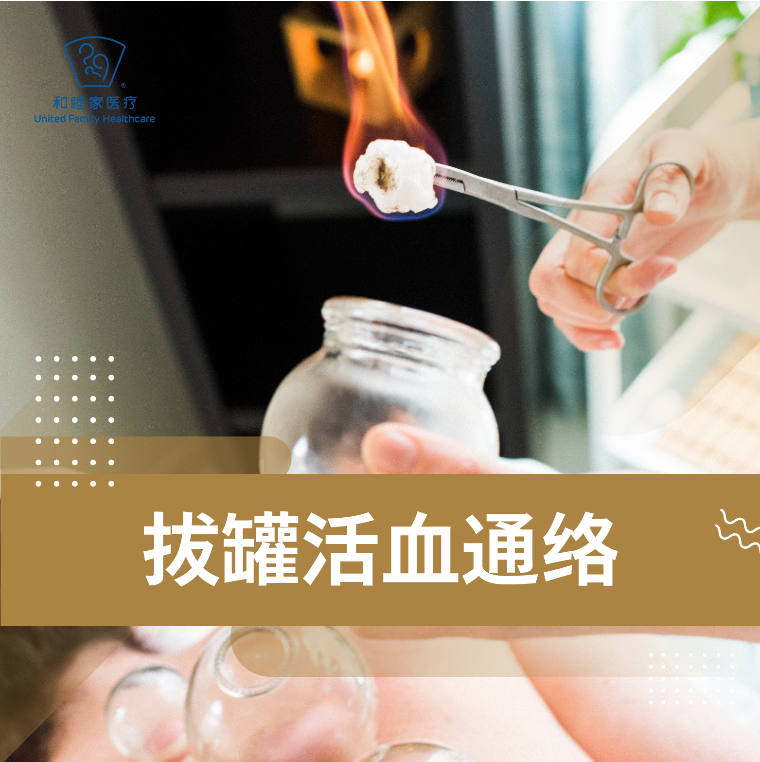 拔罐活血通络